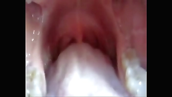 The inside of the mouth