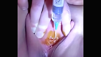 Urethral injection